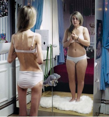 anorexia 400.jpg
